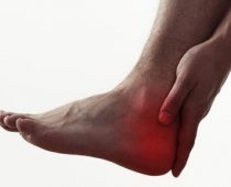 Aponévrosite plantaire : quand vos pieds vous empêchent de courir !