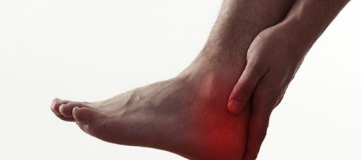 Aponévrosite plantaire : quand vos pieds vous empêchent de courir !