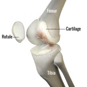 arthrose et course à pied